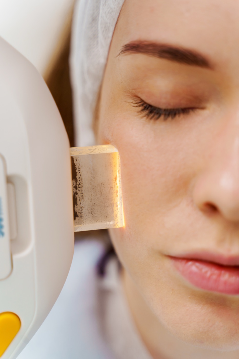Close-up of an IPL handpiece's sapphire crystal tip against skin during treatment