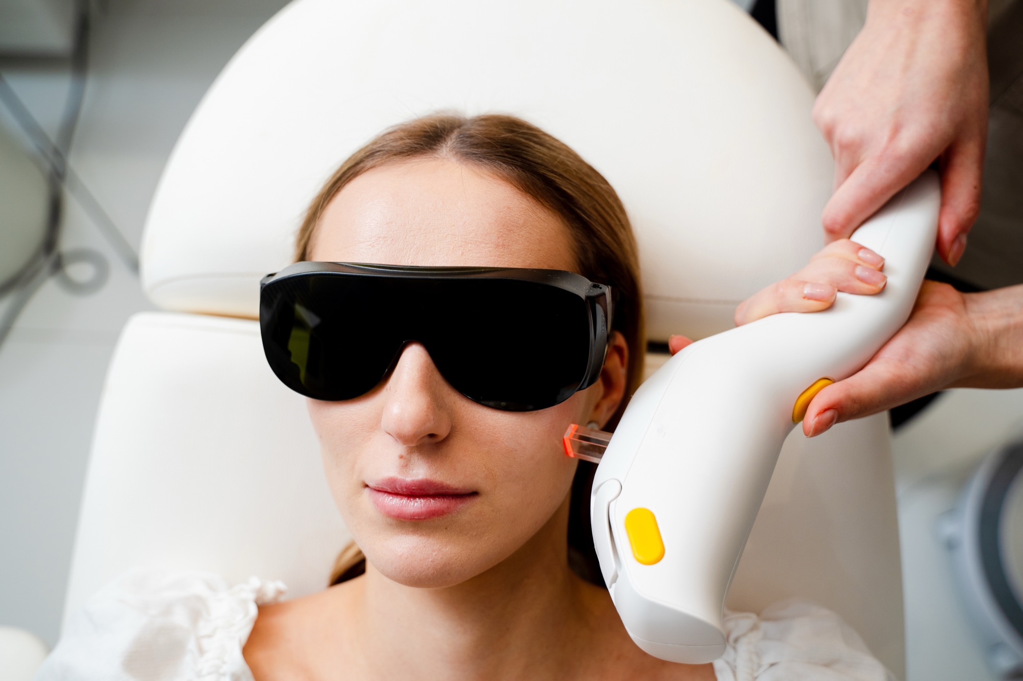 Provider treating active acne with the Lumenis Stellar M22 IPL handpiece