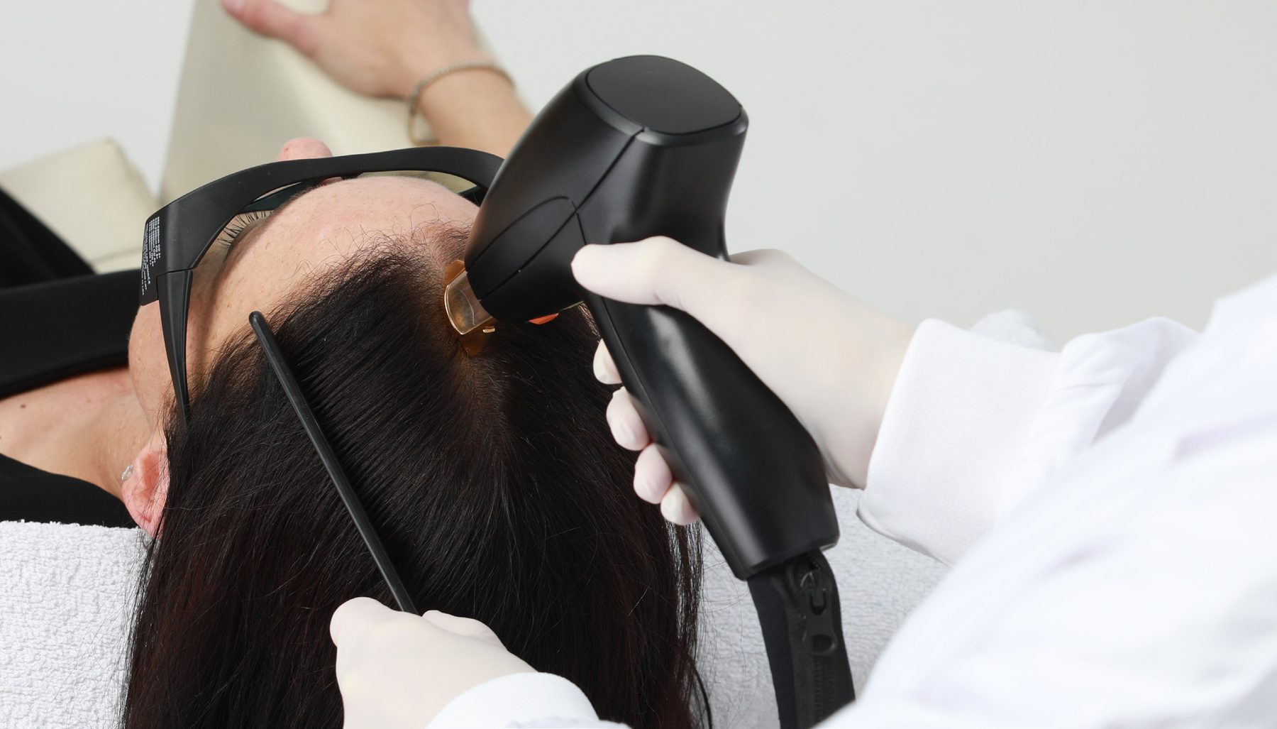 FoLix fractional laser handpiece being applied along a patient's part line during a scalp treatment session